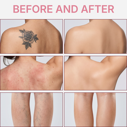 Leg Coverage Perfector