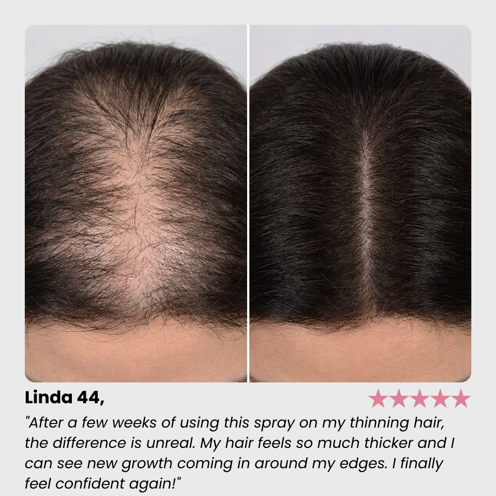 Hair Growth Spray