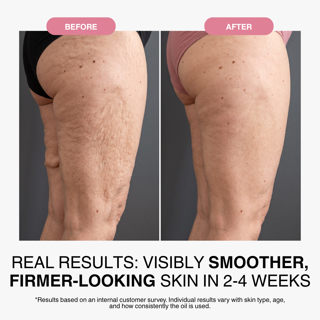 Anti-Aging Body Oil