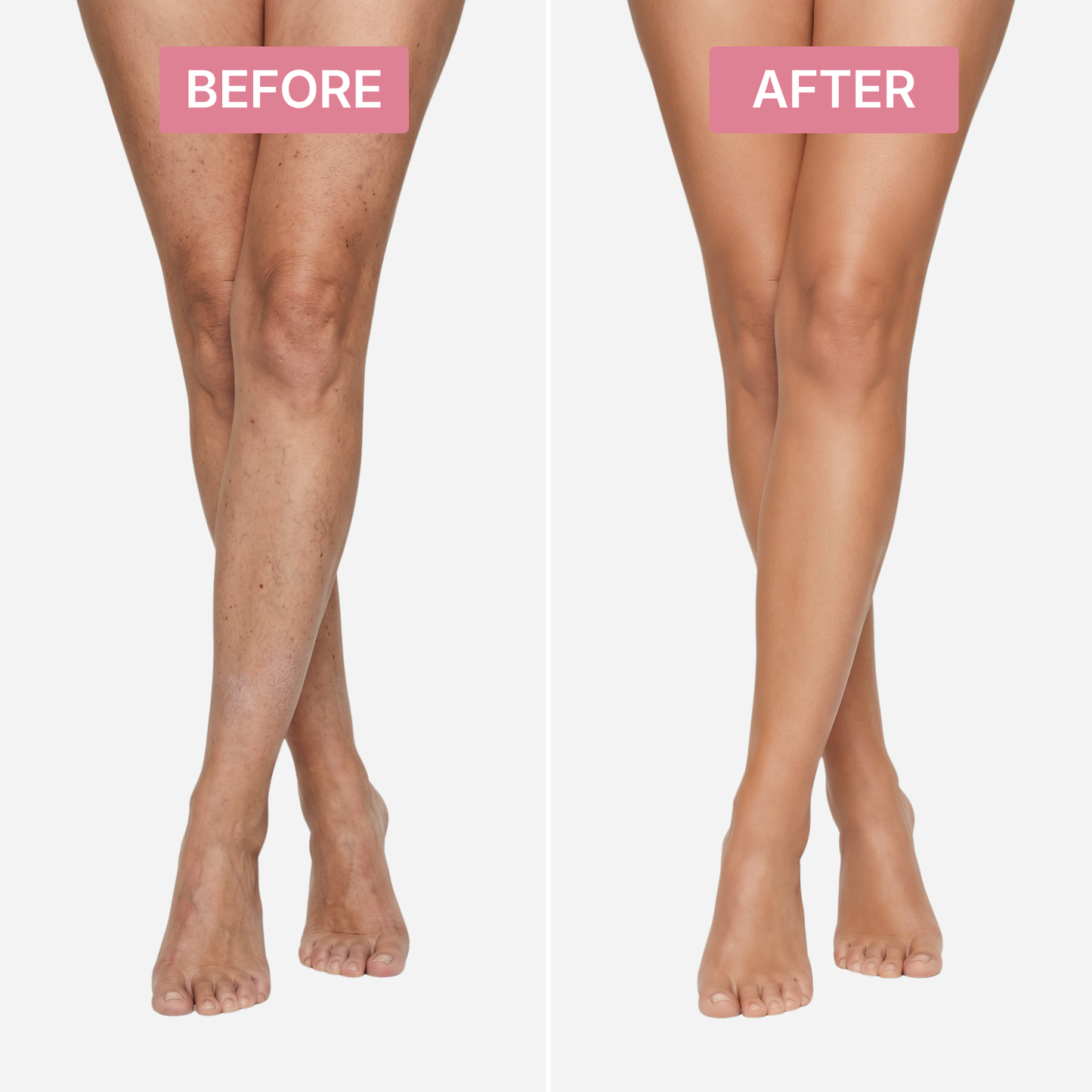 Leg Coverage Perfector