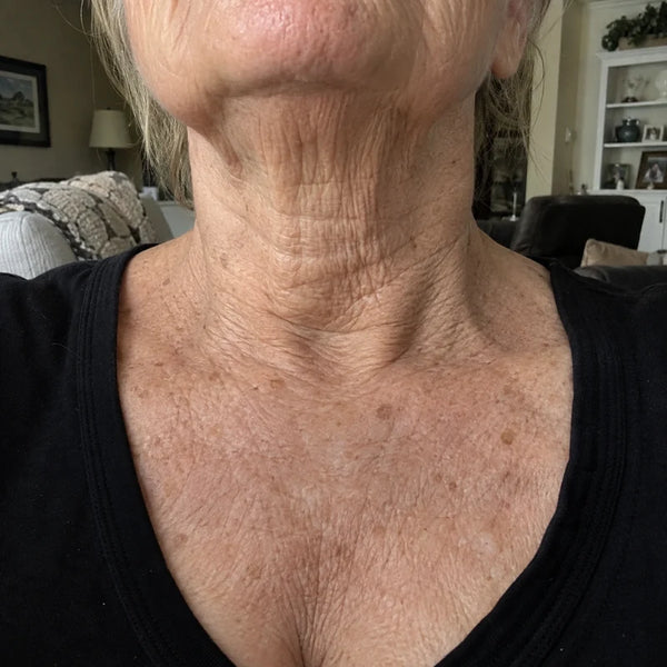 Elaine H., 64