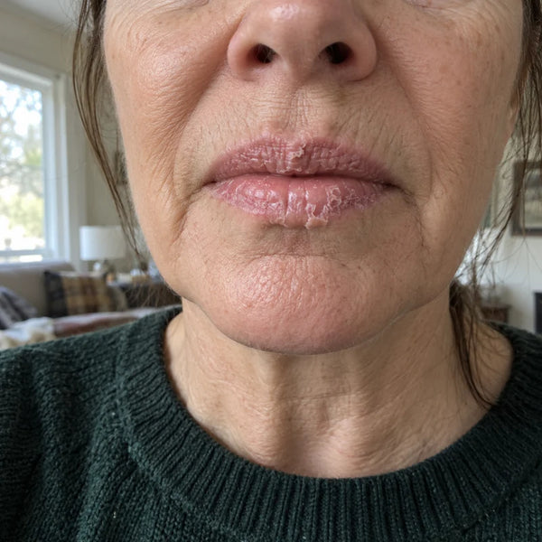 Judith A., 61